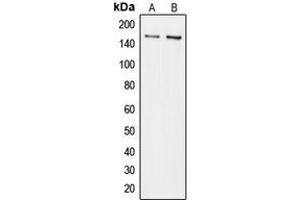 Western blot analysis of Collagen 5 alpha 3 expression in Jurkat (A), HuvEc (B) whole cell lysates. (COL5A3 antibody  (N-Term))