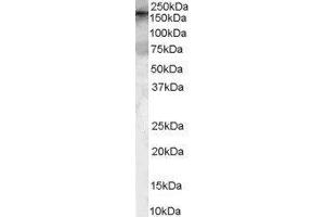 Western Blotting (WB) image for rho Guanine Nucleotide Exchange Factor (GEF) 5 (ARHGEF5) peptide (ABIN368874) (rho Guanine Nucleotide Exchange Factor (GEF) 5 (ARHGEF5) Peptide)