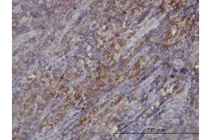 Immunoperoxidase of monoclonal antibody to RASGRP4 on formalin-fixed paraffin-embedded human tonsil. (RASGRP4 antibody  (AA 574-673))