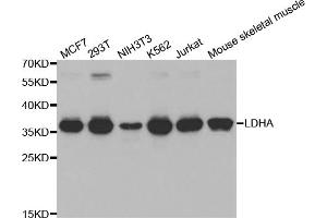 Western blot analysis of extracts of various cell lines, using LDHA antibody (ABIN5970494) at 1/1000 dilution. (Lactate Dehydrogenase A antibody)