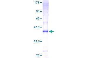 CMTM7 Protein (AA 1-175) (GST tag)