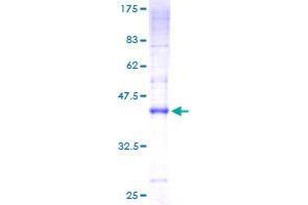 CMTM7 Protein (AA 1-175) (GST tag)