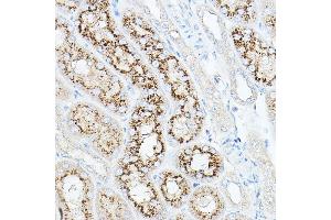 Immunohistochemistry of paraffin-embedded mouse kidney using NEU1 Rabbit pAb (ABIN6129462, ABIN6144538, ABIN6144539 and ABIN6221903) at dilution of 1:100 (40x lens). (NEU1 antibody  (AA 156-415))