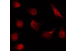 ABIN6267592 staining NIH-3T3 by IF/ICC. (MEK1 antibody  (pThr292))