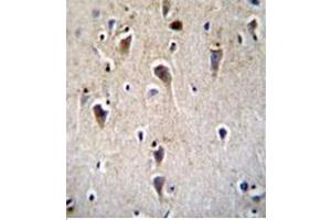 Imunohistochemistry analysis in formalin fixed and paraffin embedded human brain tissue using CRFR2D Antibody  followed by peroxidase conjugation of the secondary antibody and DAB staining. (CRHR2 antibody)