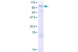 AATF Protein (AA 1-560) (GST tag)