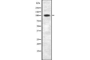 Western blot analysis of CHD1L using Jurkat whole cell lysates (CHD1L antibody  (Internal Region))