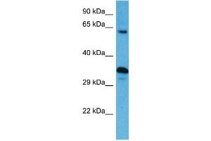 Host:  Mouse  Target Name:  SRC  Sample Tissue:  Mouse Spleen  Antibody Dilution:  1ug/ml (Src antibody  (N-Term))