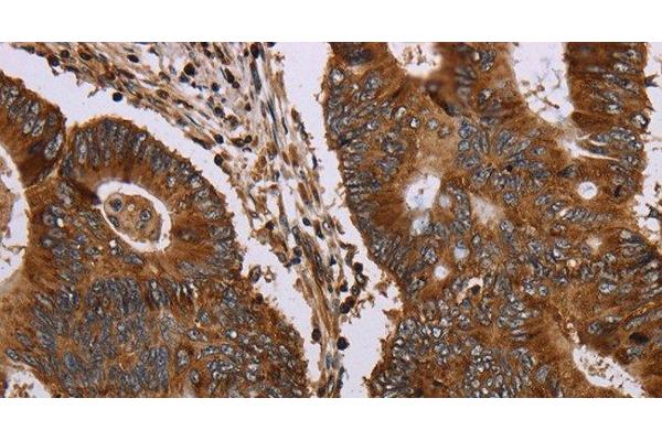 MAGEC2 antibody