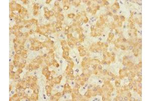 Immunohistochemistry of paraffin-embedded human liver tissue using ABIN7146045 at dilution of 1:100 (C-Type Lectin Domain Family 1, Member B (CLEC1B) (AA 55-229) antibody)