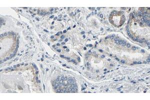 ABIN6274781 at 1/100 staining Human prostate tissue by IHC-P. (RPL36 antibody  (C-Term))