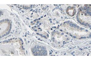 ABIN6274781 at 1/100 staining Human prostate tissue by IHC-P. (RPL36 antibody  (C-Term))