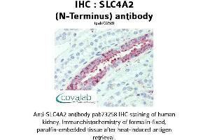 Image no. 2 for anti-Solute Carrier Family 4, Anion Exchanger, Member 2 (erythrocyte Membrane Protein Band 3-Like 1) (SLC4A2) (N-Term) antibody (ABIN1739387)