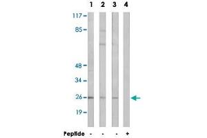 Western blot analysis of extracts from LoVo cells (Lane 1), K-562 cells (Lane 2 and lane 4) and HT-29 cells (Lane 3), using ARF4 polyclonal antibody . (ARF4 antibody  (AA 71-120))