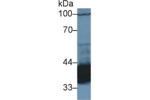 Detection of PDHb in Rat Cerebrum lysate using Polyclonal Antibody to Pyruvate Dehydrogenase Beta (PDHb) (PDHB antibody  (AA 31-341))