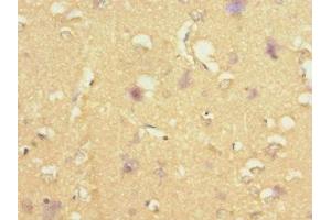 Immunohistochemistry of paraffin-embedded human brain tissue using ABIN7170732 at dilution of 1:100 (STRADA antibody  (AA 25-210))