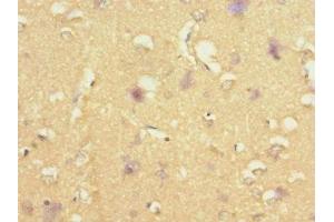 Immunohistochemistry of paraffin-embedded human brain tissue using ABIN7170732 at dilution of 1:100