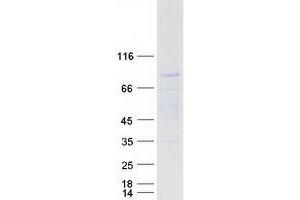 Validation with Western Blot (C1orf38 Protein (Transcript Variant 1) (Myc-DYKDDDDK Tag))