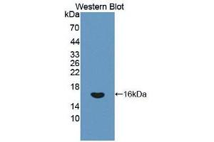 Western blot analysis of the recombinant protein. (Interferon gamma antibody  (AA 24-166))