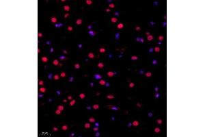Immunofluorescence of paraffin embedded rat brain using RB1 (ABIN7075477) at dilution of 1:1400 (400x lens)