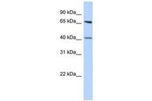 Image no. 1 for anti-Retinoblastoma Binding Protein 5 (RBBP5) (AA 431-480) antibody (ABIN6740370) (RBBP5 antibody  (AA 431-480))