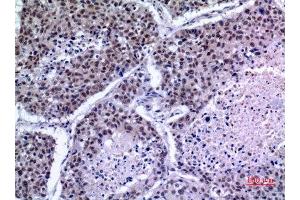 Immunohistochemistry (IHC) analysis of paraffin-embedded Human Lung, antibody was diluted at 1:100. (KLF13 antibody)