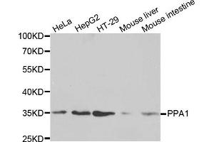 Western blot analysis of extracts of various cell lines, using PPA1 antibody. (Pyrophosphatase (Inorganic) 1 (PPA1) antibody)
