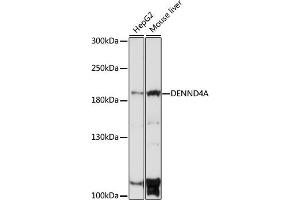 Western blot analysis of extracts of various cell lines, using DENND4A antibody (ABIN7266729) at 1:1000 dilution. (DENND4A antibody  (AA 1500-1650))