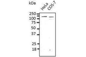 Endogenous CDHI detected with anti-CDH1at 1/500 dilution, lysate at 100 µg per Iane and rabbit polyclonal to goat lgG (HRP) at 1/10,00 dilution. (E-cadherin antibody)