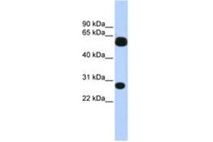 Image no. 1 for anti-Tripartite Motif Containing 16 (TRIM16) (AA 36-85) antibody (ABIN6742603) (TRIM16 antibody  (AA 36-85))