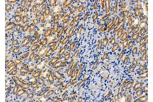 ABIN6262851 and ABIN6277626 at 1/100 staining Rat kidney tissue by IHC-P. (Kallikrein 7 antibody  (Internal Region))