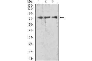 Western blot analysis using RIPK1 mouse mAb against HL-60 (1), K562 (2), and Jurkat (3) cell lysate. (RIPK1 antibody  (AA 131-277))