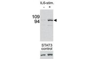 Western blot testing of p-STAT3 antibody and mouse liver tissue/lysate collected before (-) or after (+) stimulation with IL-6 injection in mouse portal vein.