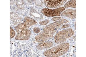 ABIN6266730 at 1/100 staining human kidney tissue sections by IHC-P. (TRIM16 antibody  (N-Term))