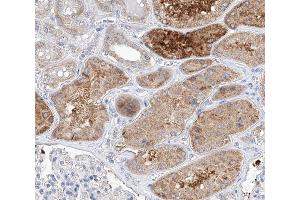 ABIN6266730 at 1/100 staining human kidney tissue sections by IHC-P.