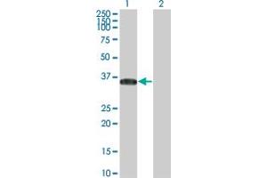 Western Blot analysis of BRDG1 expression in transfected 293T cell line by BRDG1 monoclonal antibody (M01), clone 5A10. (STAP1 antibody  (AA 186-293))