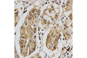 Immunohistochemistry of paraffin-embedded human stomach using MAPK10 antibody at dilution of 1:200 (x400 lens) (MAPK10 antibody  (AA 175-464))