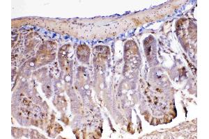 IHC analysis of ADA using anti-ADA antibody . (ADA antibody  (AA 2-241))