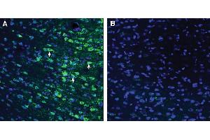 Expression of GPR18 in rat cingulate cortex.