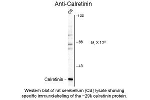 Western Blot of Anti-Calretinin (Sheep) Antibody - 200-601-D13 Western Blot of Anti-Calretinin (Sheep) Antibody. (Calretinin antibody)