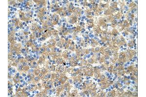 Immunohistochemistry (IHC) image for anti-MARVEL Domain Containing 3 (MARVELD3) (Middle Region) antibody (ABIN2781986) (MARVELD3 antibody  (Middle Region))