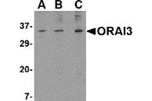 Western Blotting (WB) image for anti-ORAI Calcium Release-Activated Calcium Modulator 3 (ORAI3) (N-Term) antibody (ABIN1031497)
