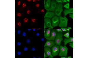 ABIN6264437 and ABIN6269102 staining HepG2 cells by IF/ICC. (Progesterone Receptor antibody  (Internal Region))