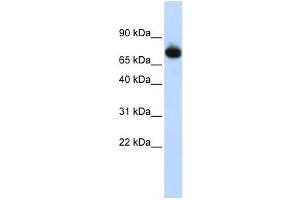 Western Blotting (WB) image for anti-Zinc Finger Protein 278 (ZNF278) antibody (ABIN2458359) (PATZ1 antibody)