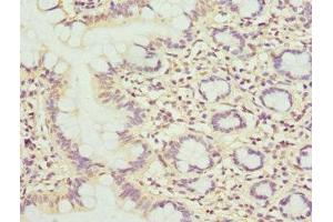 Immunohistochemistry of paraffin-embedded human small intestine tissue using ABIN7159380 at dilution of 1:100 (MBTPS1 antibody  (AA 803-1052))