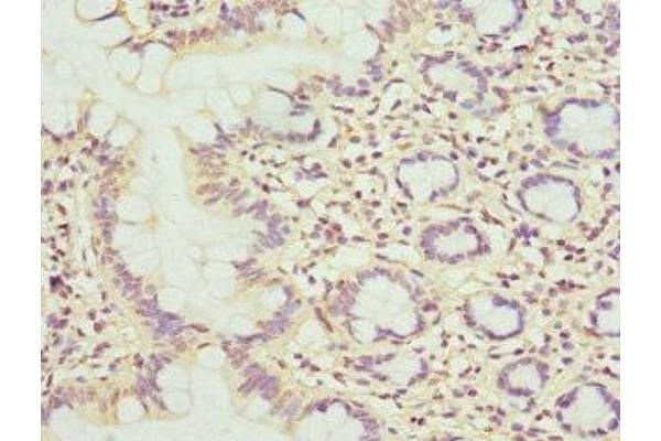 MBTPS1 antibody  (AA 803-1052)