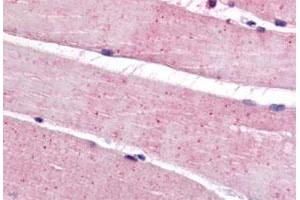 Immunohistochemistry (Formalin/PFA-fixed paraffin-embedded sections) of human skeletal muscle tissue with BEST3 polyclonal antibody . (Bestrophin 3 antibody  (C-Term))