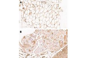 Immunohistochemistry (IHC) image for anti-Tight Junction Protein 1 (TJP1) antibody (ABIN6655950)