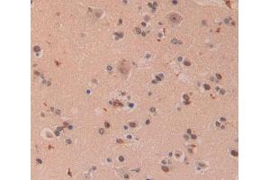 IHC-P analysis of brain tissue, with DAB staining. (XPO5 antibody  (AA 2-180))