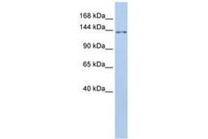Image no. 1 for anti-Transmembrane Protein 132B (TMEM132B) (AA 828-877) antibody (ABIN6741078)